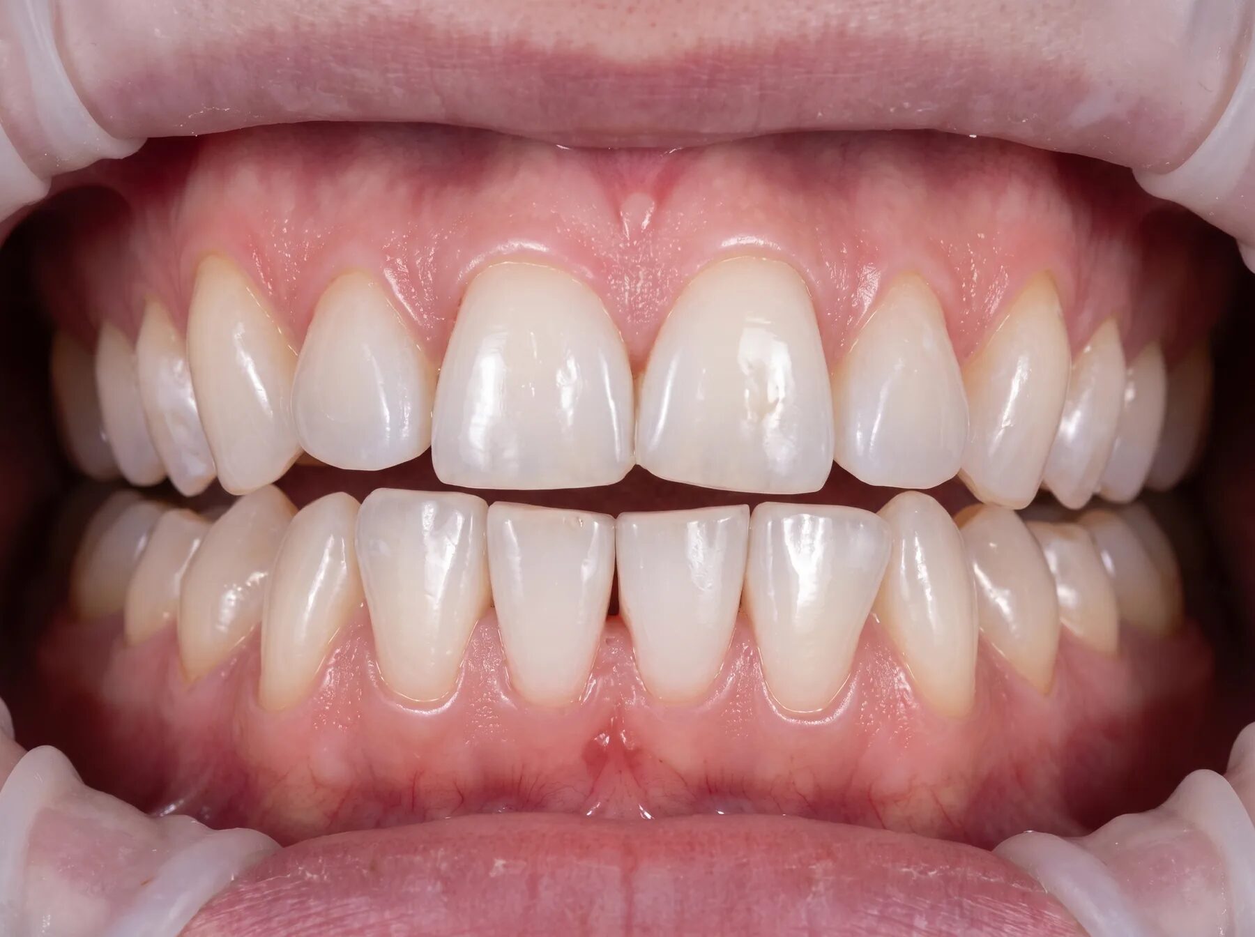 Professional hygiene. After